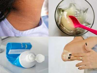 Dark Neck Remedy: 15 मिनट में सालों पुरानी गर्दन पर जमी मैल होगी दूर, टूथपेस्‍ट में मिलाकर लगाएं बस ये 2 रु की चीज