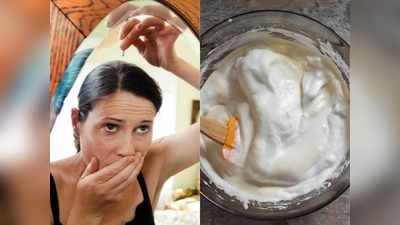 Hair loss remedy: बालों का झड़ना गारंटी के साथ होगा बंद, घर पर बनाकर लगाएं ये 4 हेयर मास्‍क