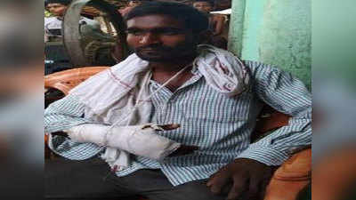 कानपुर अपहरण कांड: पीड़ित परिजनों का पुलिस पर आरोप- ऐसा पीटा कि टूट गई उंगली