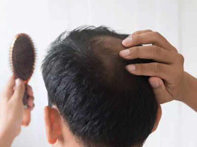 Hair Fall Reasons: इन 6 में से कोई भी बीमारी शरीर में पनपे तो तेजी से गिरते हैं बाल