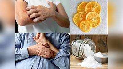 Home Remedy For Itching : शरीर में होने वाली खुजली को कम कर देगा यह घरेलू नुस्खा