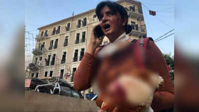 Beirut Blast News: बेरुत ब्लास्ट की आपबीती...टीवी पत्रकार का जल गया घर, मेरठ की है बेटी