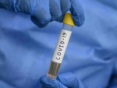 Coronavirus In Jalgaon जळगावात करोनाची भीती वाढली; २४ तासांत ५२० नवे रुग्ण