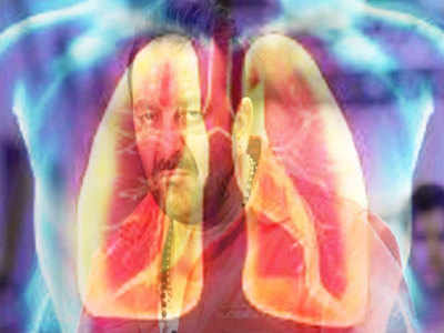 Sanjay Dutt Lung cancer: क्यों होता है लंग कैंसर और क्या होती है स्टेज-3, जानें जरूरी बातें
