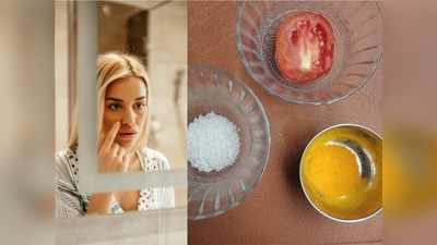 Acne-prone skin के लिए बेस्‍ट है टमाटर के ये 3 उपाय, ऐसे करें अप्‍लाई