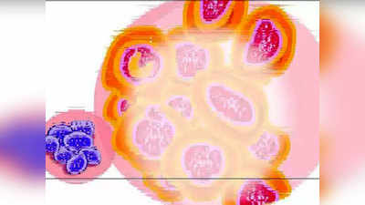 Nipah Virus Infection Symptoms: निपाह वायरस के लक्षण और इससे बचने के तरीके
