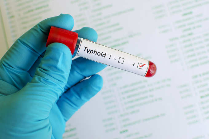 Typhoid positive