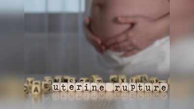 Uterine Rupture : डिलीवरी के समय यूट्राइन रप्‍चर के कारण जा सकती है शिशु की जान
