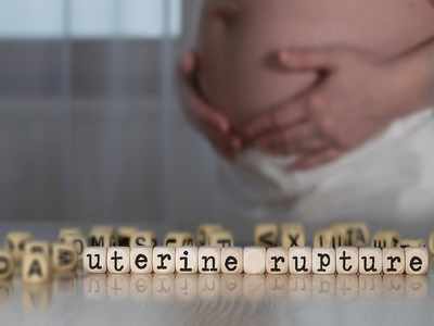 Uterine Rupture : डिलीवरी के समय यूट्राइन रप्‍चर के कारण जा सकती है शिशु की जान