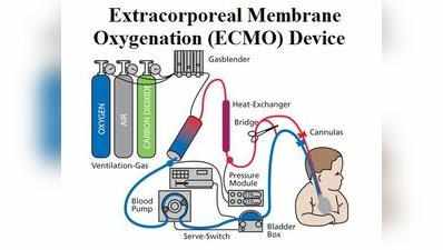 ECMO: எக்மோ சிகிச்சை என்றால் என்ன? கட்டணம் எவ்வளவு?