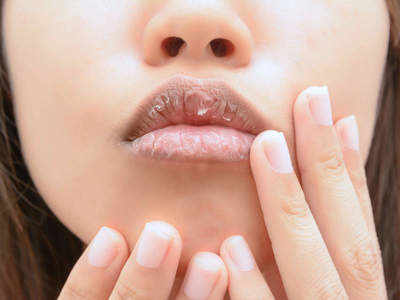 coconut oil for lips: कॉस्मेक्टिक्स से करें तौबा, इन प्राकृतिक तरीकों से पाएं सॉफ्ट पिंक लिप्स