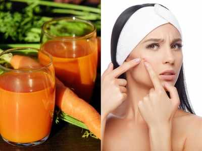 Acne की वजह से स्‍किन को न होने दें खराब, गाजर के जूस का ऐसे करें इस्‍तेमाल