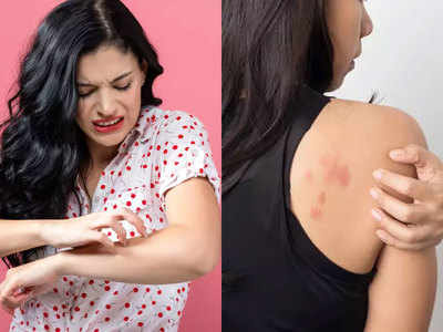Infection Free Skin: घर में तैयार करें नैचरल ऑइल ब्लेंड और पाएं निरोग त्वचा