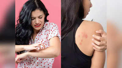 Infection Free Skin: घर में तैयार करें नैचरल ऑइल ब्लेंड और पाएं निरोग त्वचा