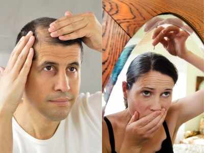 Hair Fall: इन 6 कारणों से जल्‍दी झड़ने लगते हैं बाल, महिला हों या पुरुष जल्‍द करें बचाव