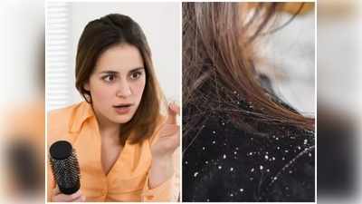 Dandruff Symptoms : பொடுகு வரப்போவதை உணர்த்தும் முக்கிய அறிகுறிகள்,பெண்கள் ஆண்கள் இருவருக்கும்!