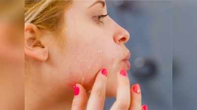 Skin Care Routine: तेजी से बदल रहा है मौसम, जानें अक्‍टूबर में ड्राय और ऑयली होती स्‍किन का कैसे रखें ख्‍याल