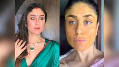 Face pack: किचन में पड़ी इन 6 चीजों से बनाएं फेस पैक, कॉम्बिनेशन स्किन बनेगी और भी ज्‍यादा सुंदर