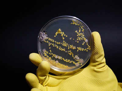 रोजच्या वापरातील या वस्तूंवर असतात ४०० पट जीवाणू