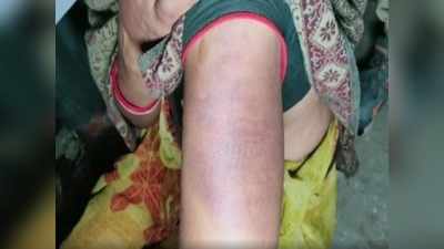 Nalanda: डॉक्टर की दंबगई- चोरी का आरोप लगा महिला सफाई कर्मी को किया अगवा, फिर नंगा कर पीटा