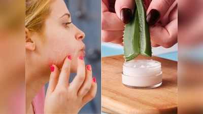 सर्दियों में ड्रायनेस दूर करने के लिए Aloe vera से बनाएं ये फेस सीरम, आएगा हीरे जैसा निखार