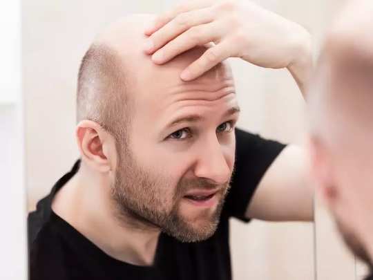 early symptoms of hair loss, Hair Fall Symptoms :முடி கொட்ற பிரச்சனை  தீவிரமா இருக்கு என்பதை எப்படி கண்டுபிடிப்பது? அதுக்கு தீர்வு என்ன? - common  causes and symptoms for hair fall ...