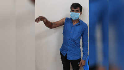 Noida News: मशीन की चपेट में आकर कट गया था हाथ, 8 घंटे की मैराथन सर्जरी के बाद डॉक्टरों ने जोड़ा