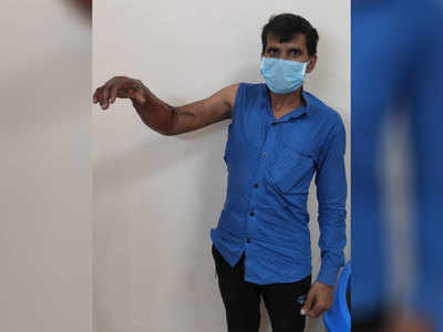 Noida News: मशीन की चपेट में आकर कट गया था हाथ, 8 घंटे की मैराथन सर्जरी के बाद डॉक्टरों ने जोड़ा