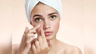 How To Remove Pimple: रातों रात उग आए पिंपल को दूर करने का नैचरल तरीका