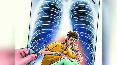 Mirzapur News: घर-घर जाकर ढूंढे जाएंगे टीबी के मरीज, 3 चरणों में चलेगा अभियान