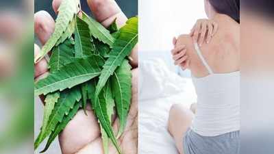 Skin allergy से परेशान लोग जरूर अपनाएं ये घरेलू उपाय, दो दिन में ठीक होगी समस्‍या