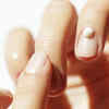 Home remedies for nails pain in hindi: अंगूठे के मुड़े नाखून में हो रहा तेज  दर्द? | TheHealthSite.com हिंदी