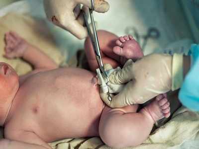 Cord clamping : शिशु के जन्म के तुरंत बाद नहीं काटनी चाहिए गर्भनाल, बच्चे को मिलते हैं कई फायदे