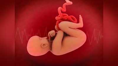Umbilical Cord Prolapse : डिलीवरी के समय इसकी वजह से रूक सकती है बच्‍चे की सांसें, पेट में भी मर सकता है बच्‍चा