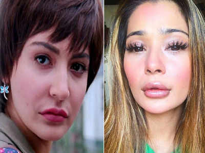 अनुष्का शर्मा से लेकर सारा खान तक, प्लास्टिक सर्जरी ने किया इन हसीनाओं के चेहरे का कबाड़ा