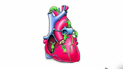 Heart Surgery: ब्लूटूथ के जरिए दिल जुड़ गया स्मार्टफोन से