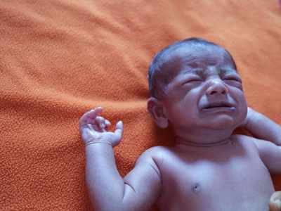 इस बीमारी से नीला पड़ जाता है नन्‍हे शिशु का शरीर, लक्षण और कारण जान उड़ जाएंगे होश
