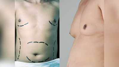 पुरुषों में Breast Cancer के होते हैं ये 4 स्‍टेज, बॉडी में दिखें ऐसे बदलाव तो तुरंत करवाएं जांच