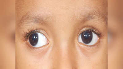 Rare Surgery: दोनों आंखों में जन्मजात मोतियाबंद था, 11 महीने के बच्चे की सर्जरी कर लौटाई रोशनी