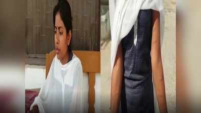 Bihar Crime Samachar: दहेज के लिए बहू को गर्म सलाखों से दागा, चीखी तो ससुराल वालों ने TV चलाकर तेज कर दी आवाज