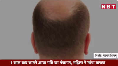 Video: 1 साल बाद सामने आया पति का गंजापन, महिला ने मांगा तलाक 