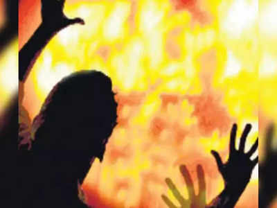 Hyderabad News: महिला दिवस पर वह बेबस जिंदा जल रही थी...कोई बचाने नहीं आया, मांगे थे उधार के पैसे, मिली मौत