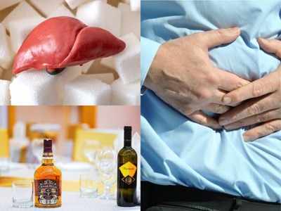 हल्‍के में लेंगे तो लिवर तक डैमेज कर सकती है ये बीमारी, जानें Fatty liver disease के बारे में सब-कुछ