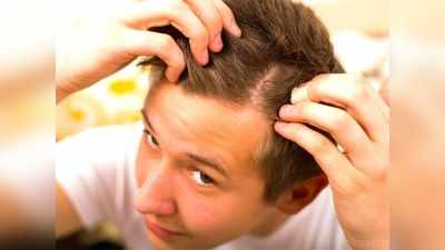 Stress and Hair loss: ज्‍यादा स्ट्रेस लेने वाले लोग जल्‍दी हो जाते हैं गंजे, हार्वर्ड की रिसर्च का दावा