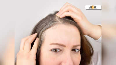 Stress and Hair loss:অত্যধিক স্ট্রেস নেওয়া ব্যক্তিদেরই দ্রুত টাক পড়ে! দাবি গবেষণার
