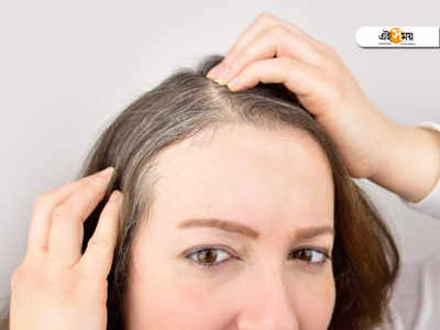 Stress and Hair loss:অত্যধিক স্ট্রেস নেওয়া ব্যক্তিদেরই দ্রুত টাক পড়ে! দাবি গবেষণার