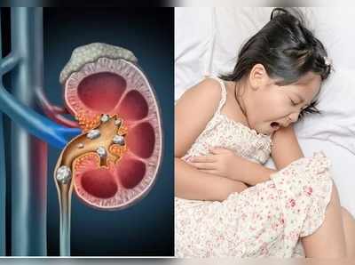 Kidney stone in kids : पेरेंट्स की इस गलती की वजह से, बच्‍चों को हो सकती है पथरी, जानकर जल्‍दी कर लें सुधार