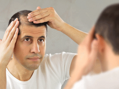 Alopecia Home Remedies: गंजापन बढ़ने की हैं ये 5 वजह, नहीं उग रहे नए बाल तो जानें समाधान