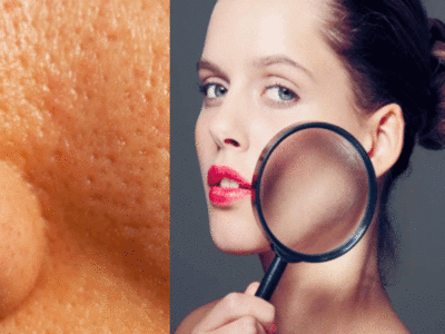 DIY Tips For Open Pores: ओपन पोर्स का काल हैं ये घरेलू नुस्खे, त्वचा बनेगी एकदम स्मूद