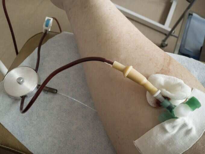 ​प्लाज्मा थेरेपी (Plasma therapy) क्या है?